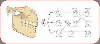 TMJ treatment 001.jpg