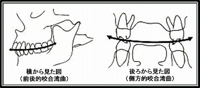 スピー の 湾曲